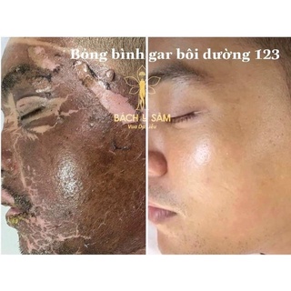 Dưỡng da 123 Bạch linh - Bách y sâm (40ml)