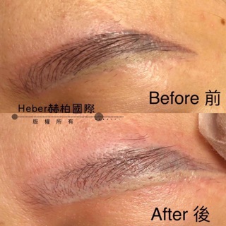 Xoá Phun Xăm YD | Dụng Cụ Phun Xăm