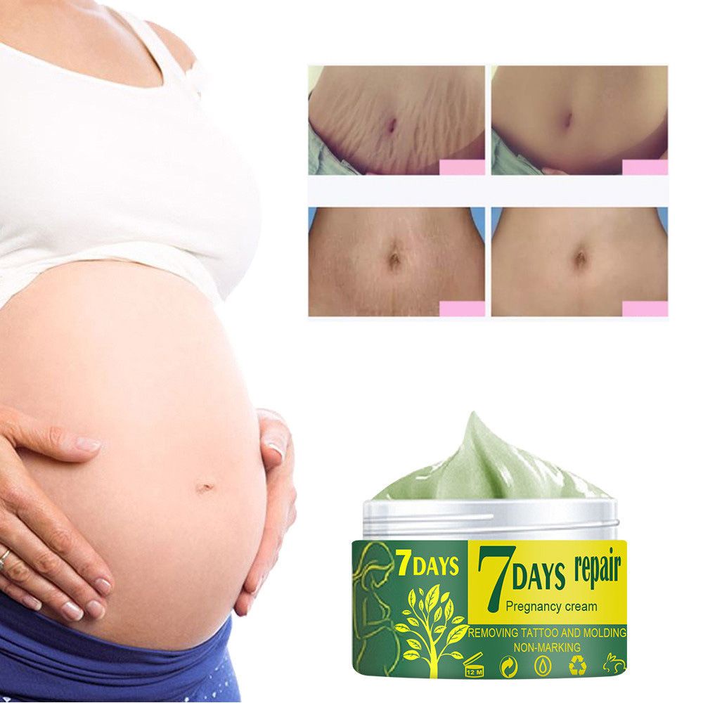 Kem Hỗ trợ giảm sẹo chăm sóc da BORAGE cho phụ nữ mang thai