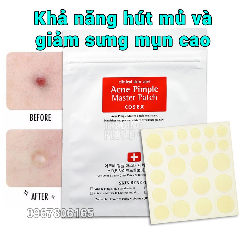 Miếng dán mụn ACNE PIMPLE/CLEAR FIT MASTER PATCH-Hàn Quốc( MẪU MỚI)