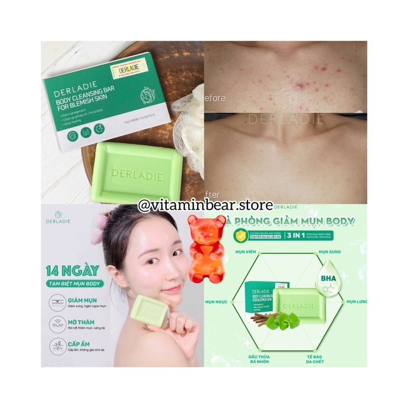 SOAP TẮM GIẢM MỤN BODY DERLADIE HIỆU QUẢ SAU 14 NGÀY SỬ DỤNG