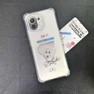 Ốp Lưng Xiaomi Mi 11 Dẻo Trong Suốt Chống Sốc