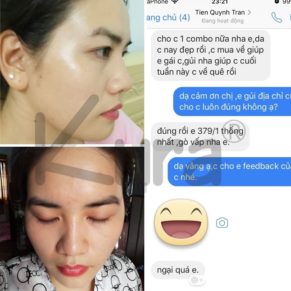 Kem Dưỡng Da Cao Cấp - Kura Beauty Face (3in1) | BigBuy360 - bigbuy360.vn