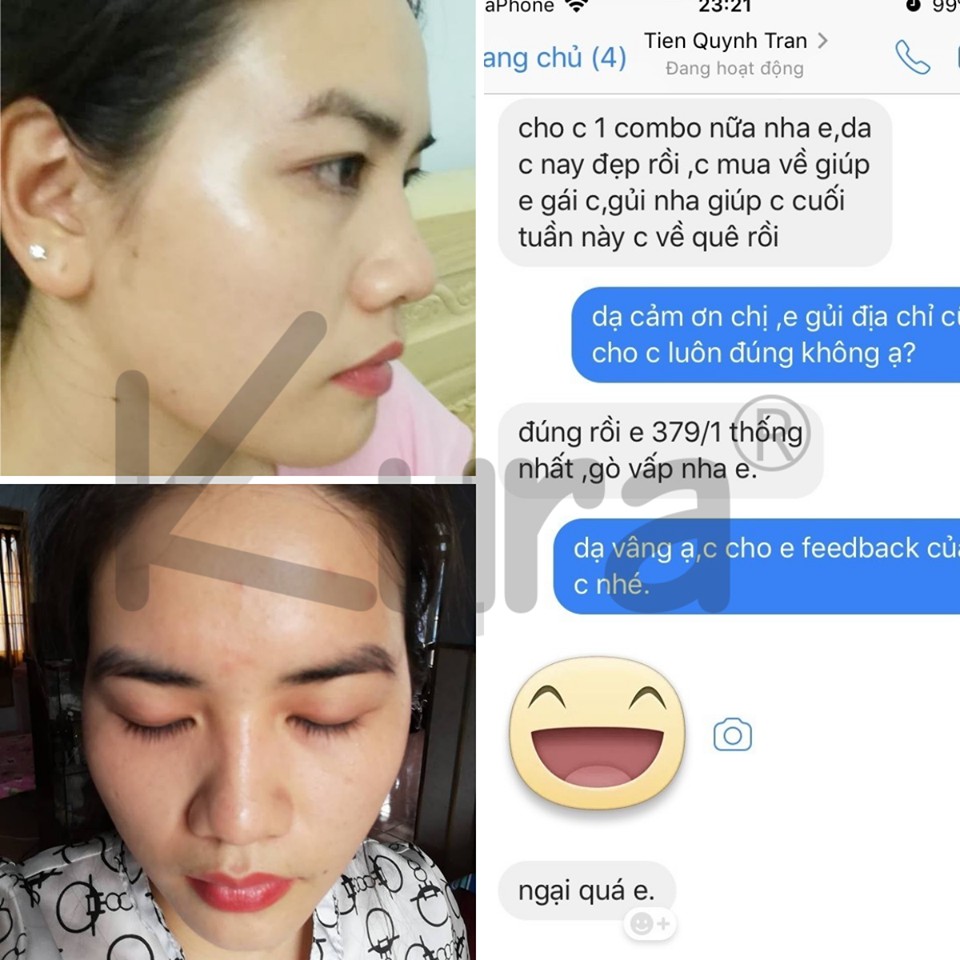 Sữa Rửa Mặt Cao Cấp - Kura Perfect Cleanser 50 ML