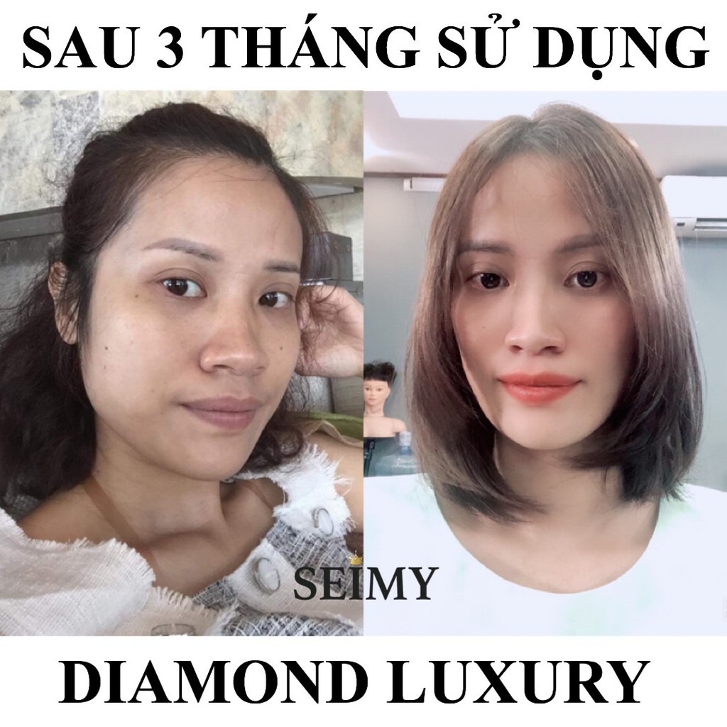 Kem dưỡng da mặt nhau thai Seimy - Diamond Luxury 30g dưỡng trắng, cấp ẩm, mờ nám, giảm mụn