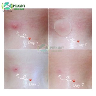MIẾNG DÁN MỤN MAYAN CARE 0.8