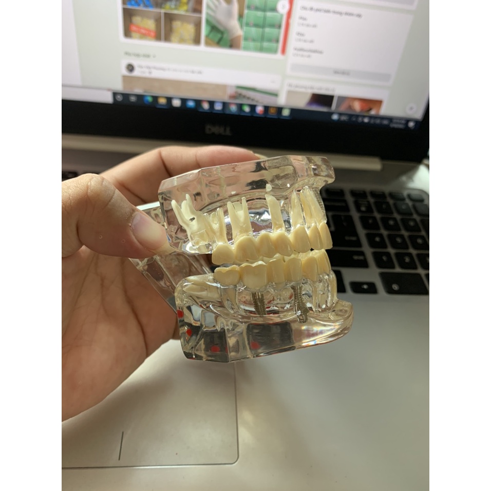 [Hàng mới về] Mô hình hàm răng đa năng chuyên dụng dành cho nha khoa