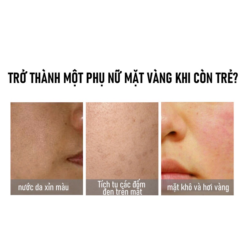 Mặt Nạ Dưỡng Ẩm Làm Da Trẻ Hơn, Làm Mờ Đốm Đen Và Nếp Nhăn