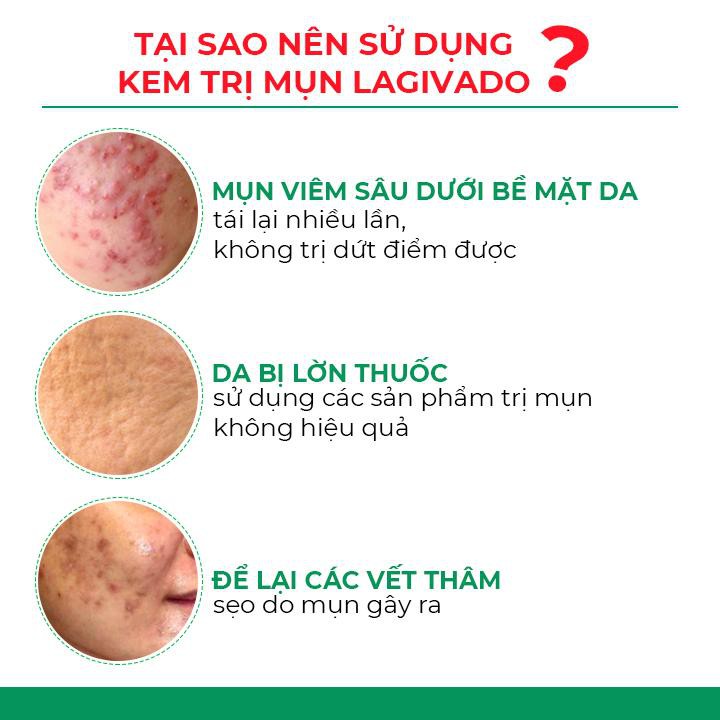 Kem chấm giảm mụn ngừa thâm sẹo rỗ, thông thoáng lỗ chân lông Dr. Atreat Cream 30g - Katta