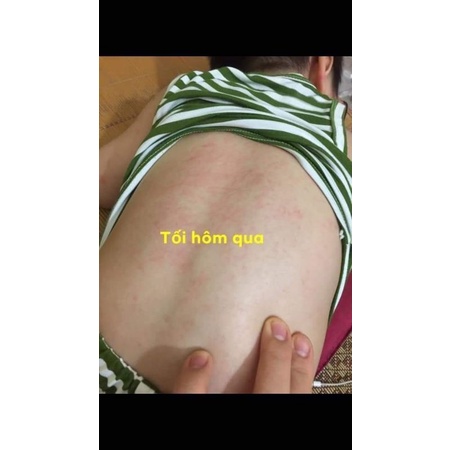 Dr.baby - Baby care cream: hăm tã, chàm sữa, rôm sảy, mẩn ngứa