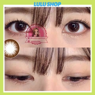 Lens choco Circle có cận