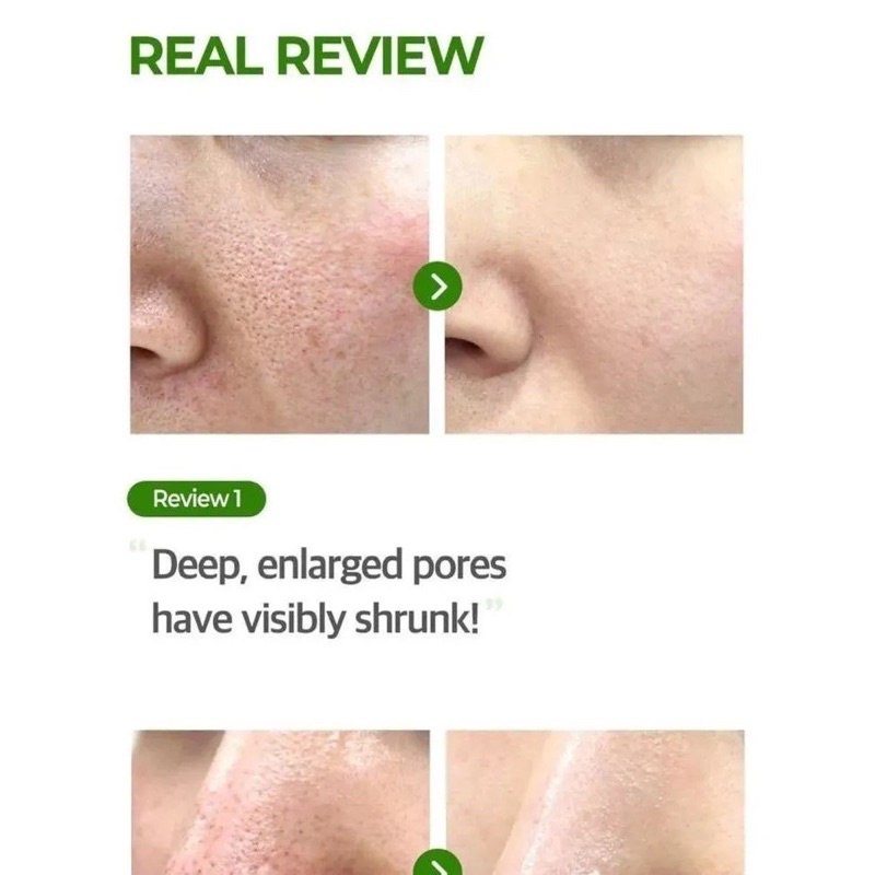 Serum Se Khít Lỗ Chân Lông Some By Mi Super Matcha Pore Tightening 50ml Chính Hãng