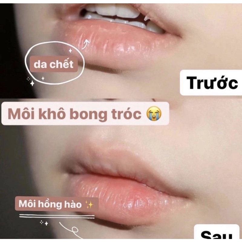Son Dưỡng Môi Vaseline dạng hũ 7g