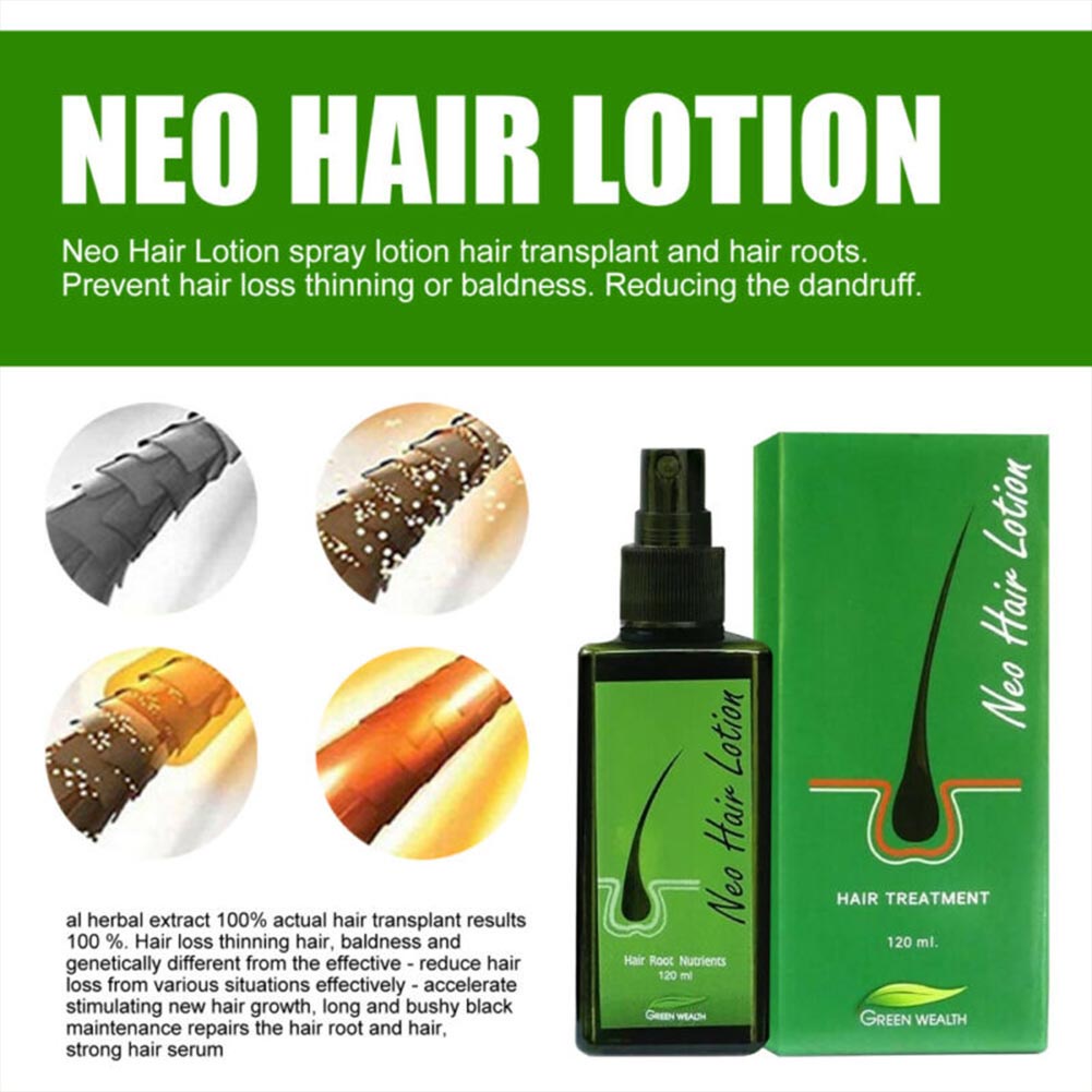 Hair Regrowth Lotion Haircare Hair Loss Oil Baldness Hair thinning 120ml Spray