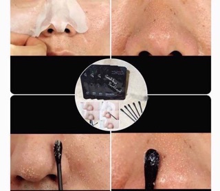 Miếng dán đẩy mụn Good bye Blackhead – Ciracle