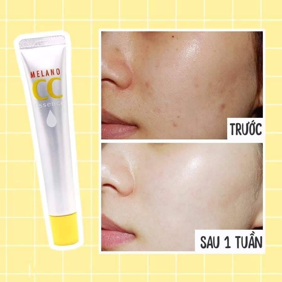 💛TINH CHẤT DƯỠNG DA VITAMIN C MELANO CC BEAUTY ESSENCE