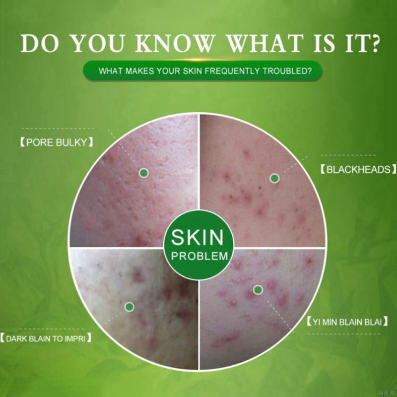 [Hàng mới về] Kem Giảm Mụn Dưỡng Ẩm Thu Nhỏ Lỗ Chân Lông Làm Săn Chắc Da 20g