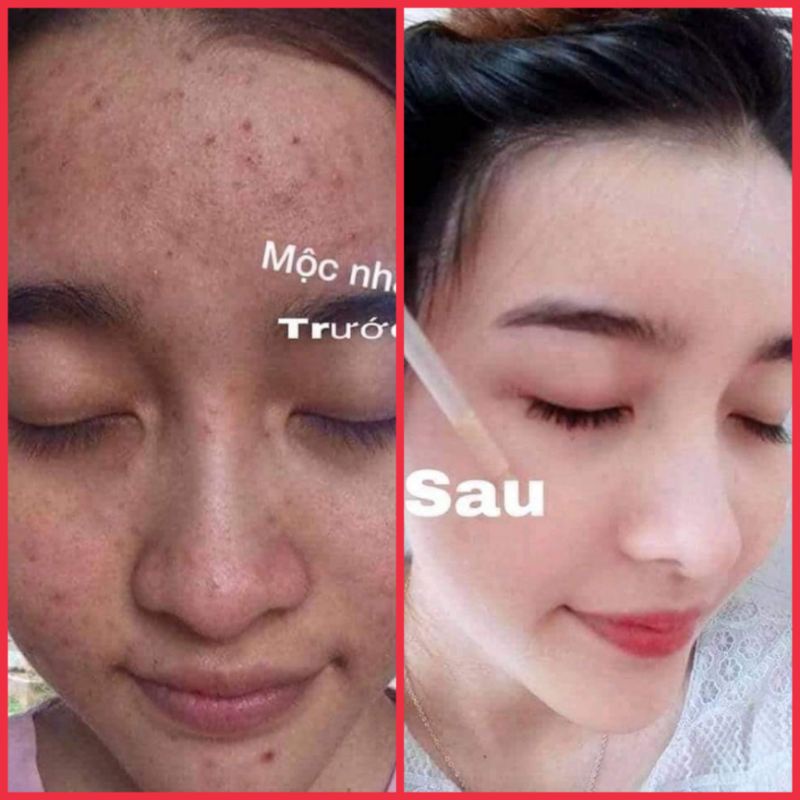 Đông Y Mộc Nhân Tái Tạo Da Thiên Nhiên Lọ 100ml