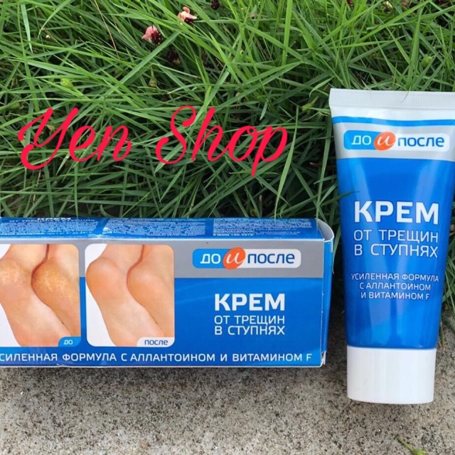 💥💥💥Kem giảm nứt gót chân Nga💥💥