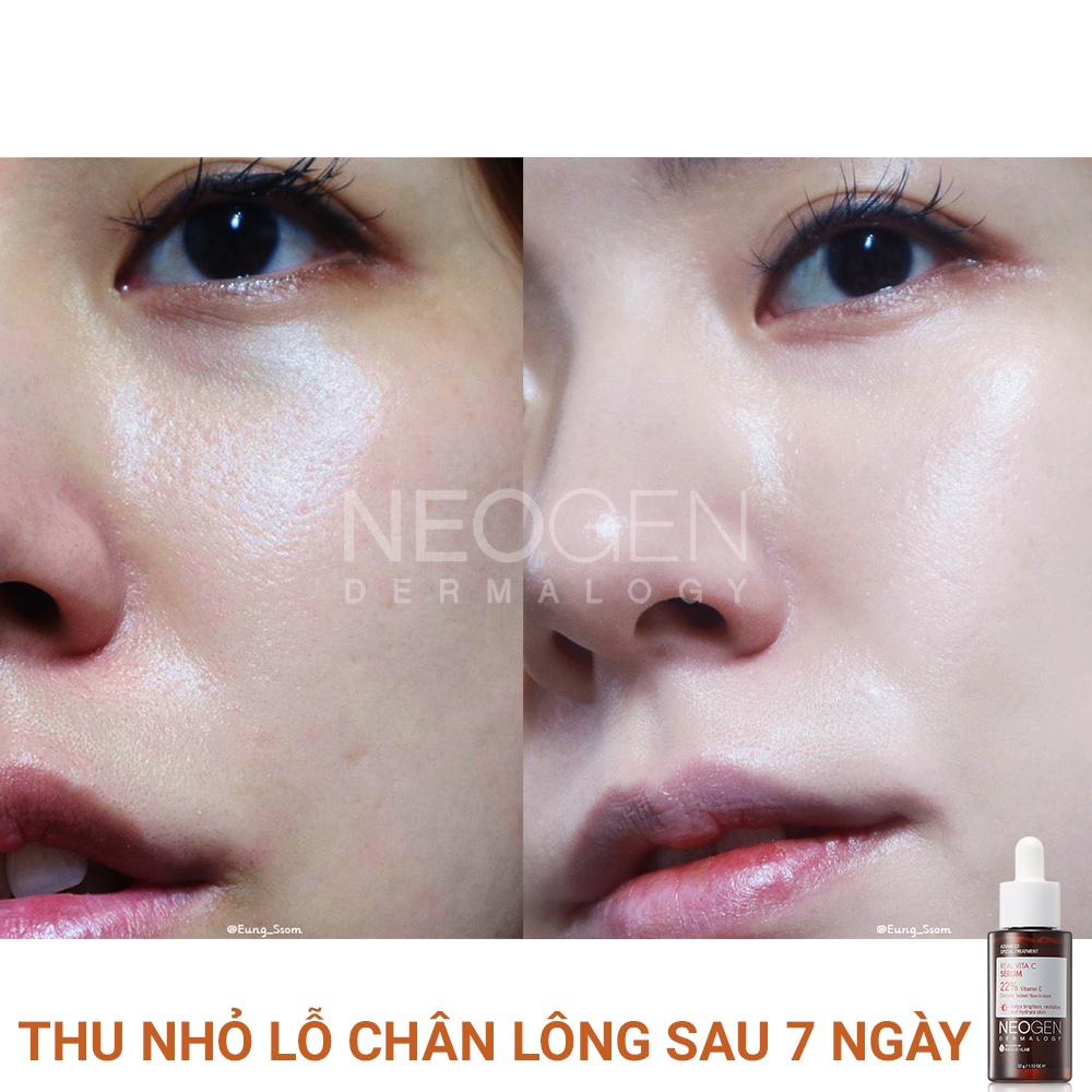 Siêu Tinh Chất Mờ Thâm Dưỡng Trắng Vitamin C SAP Neogen Dermalogy Real Vita C Serum 32g