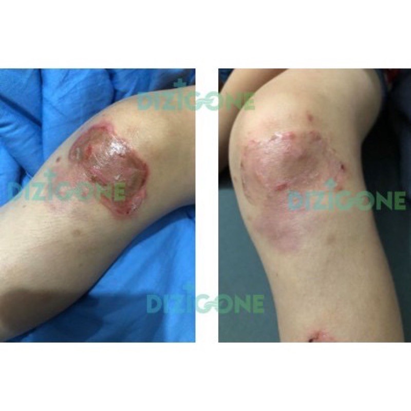 Xịt Dizigone làm sạch da | BigBuy360 - bigbuy360.vn