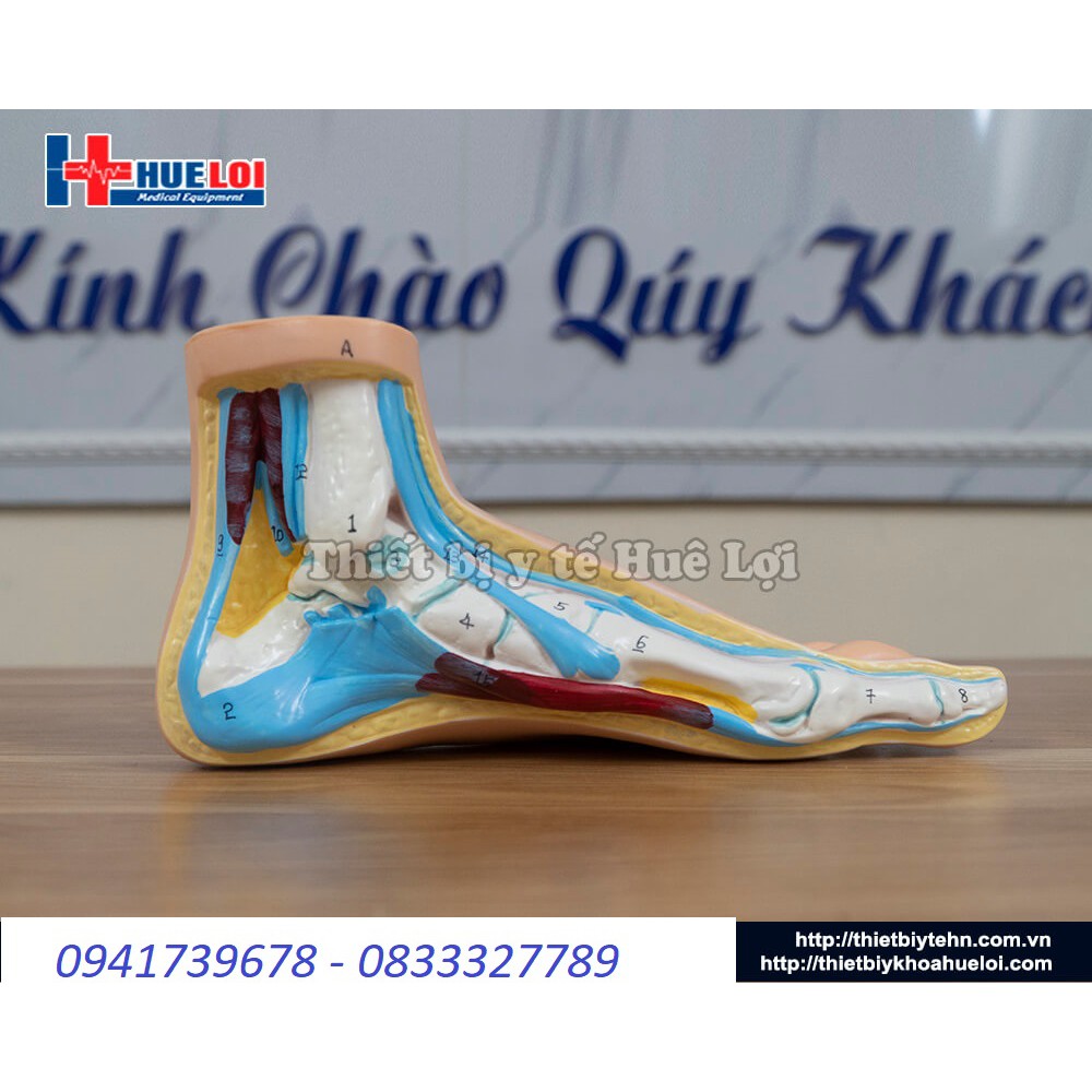 Mô hình bàn chân bệnh lý