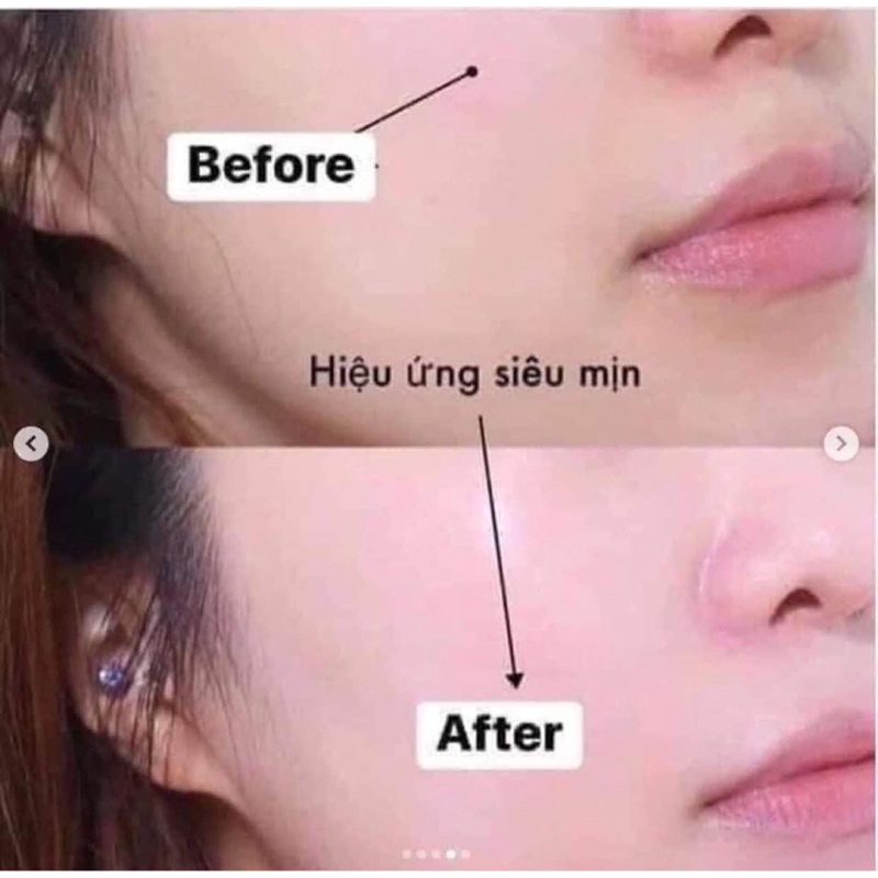 [Chính hãng] 𝐊𝐞𝐦 𝐜𝐡𝐨̂́𝐧𝐠 𝐧𝐚̆́𝐧𝐠 𝐒𝐊𝐈𝐍 𝐀𝐐𝐔𝐀 NHẬT BẢN