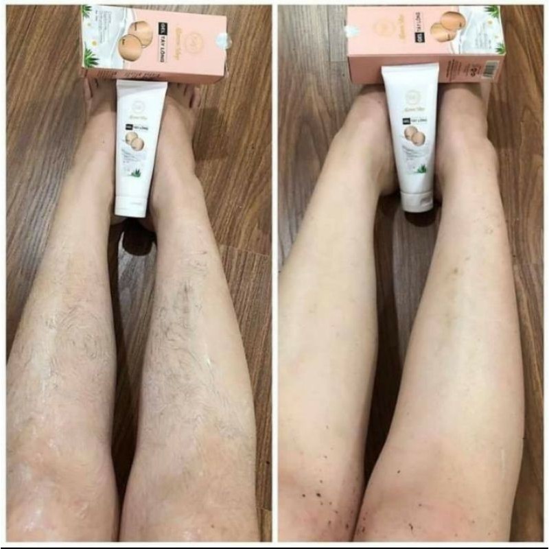 Kem triệt Râu, lông Vĩnh viễn làm trắng da an toàn cho da nhạy cảm