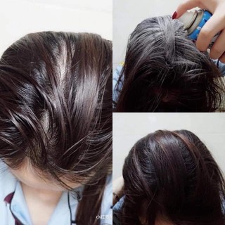 DẦU GỘI KHÔ BATISTE