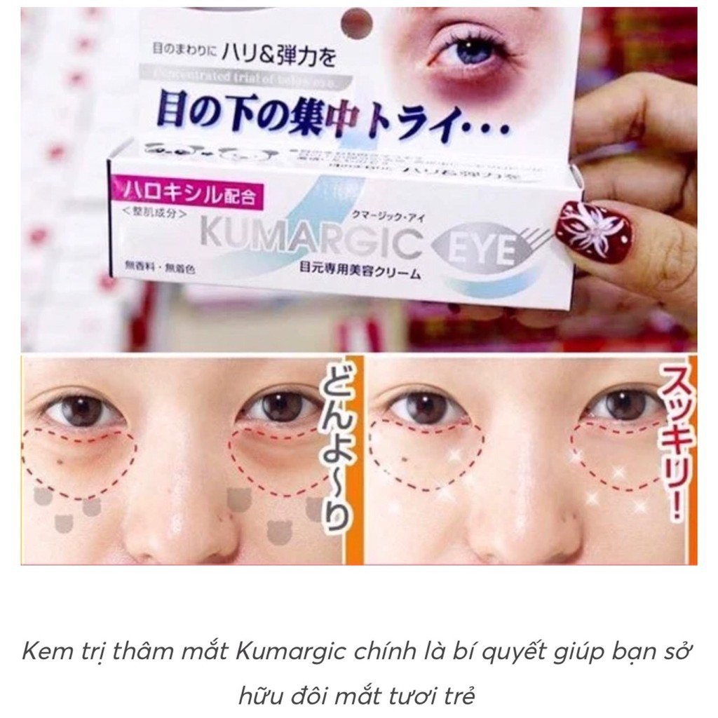 Kem THÂM QUẦNG MẮT Kumargic Eye Nhật Bản 20g mờ thâm quầng mắt, bọng mắt, giảm nếp nhăn, vết chân chim . | BigBuy360 - bigbuy360.vn