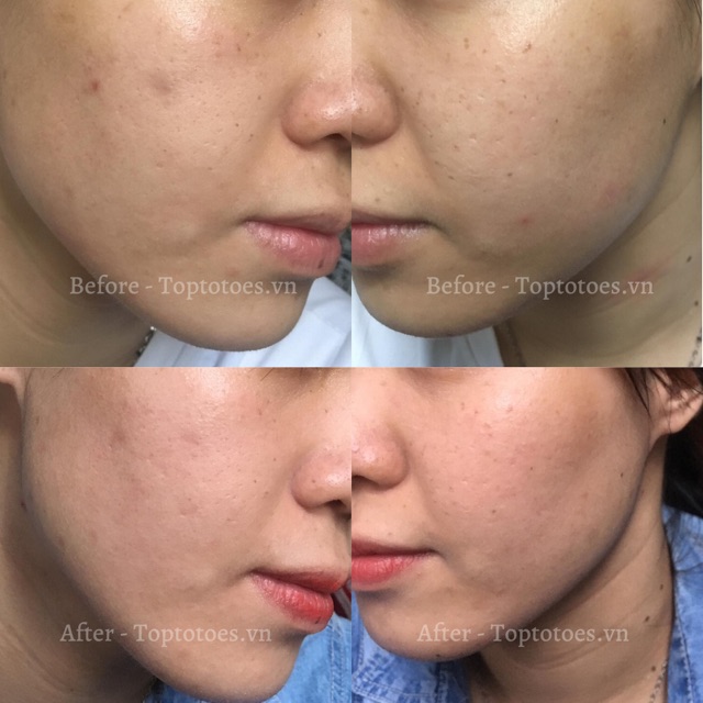 [HÀNG NHẬP KHẨU] Serum Teana Super Peptides ASAP dưỡng trắng, mờ thâm, cải thiện kết cấu da | BigBuy360 - bigbuy360.vn