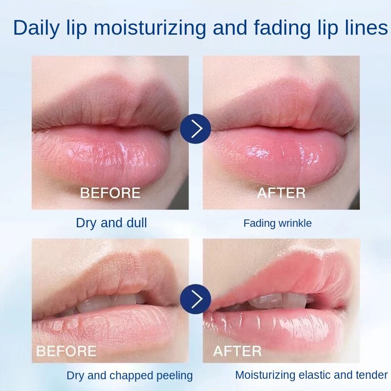 Son Dưỡng Môi Giữ Ẩm Chống Nứt Nẻ Nicor Vaseline