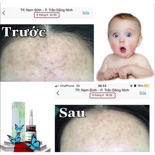 Thảo Mộc Xanh Serum ❗Free Ship