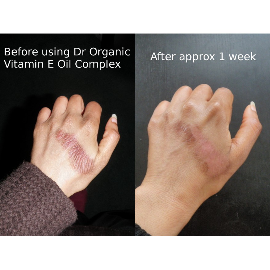 Tinh dầu Vitamin E nguyên chất Dr Organic Vitamin E Pure Oil Complex 50ml | BigBuy360 - bigbuy360.vn