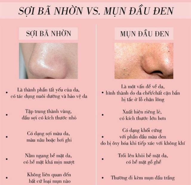 Gell rửa mặt than hoạt tính, loại bỏ mụn đầu đen