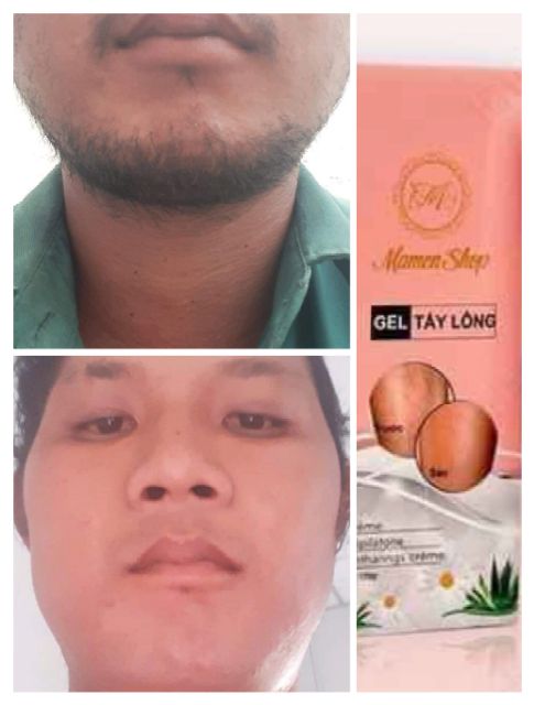 Kem triệt lông râu thảo dược thiên nhiên vĩnh viễn tận gốc mamenshop