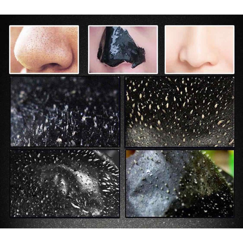 Gel lột Mụn Than Tre Bioaqua Charcoal ♥️FREESHIP♥️ Hút sạch mụn cám, mụn đầu đen. Thải độc chì- Sáng da | Thế Giới Skin Care