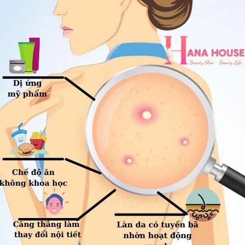 Xà phòng tắm giúp trắng da Gluta-C toàn thân với Kojic Acid, Vitamin C & Glutathione kết hợ