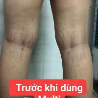 Kem rạn da multi 16 hủ nhỏ 20g