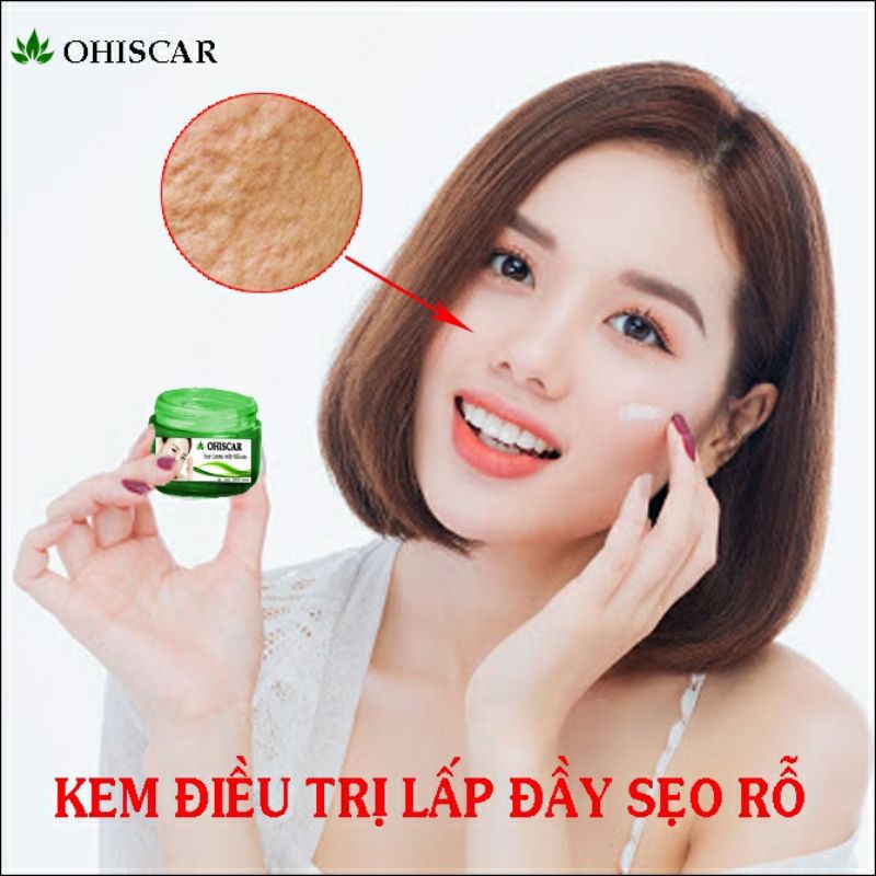 Kem Mờ Sẹo Rỗ Lâu Năm Ohiscar Hàn Quốc