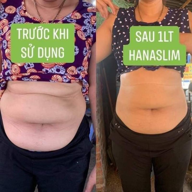 Kẹo giảm cân HANA SLIM CHÍNH HÃNG MUA 1 TẶNG 1