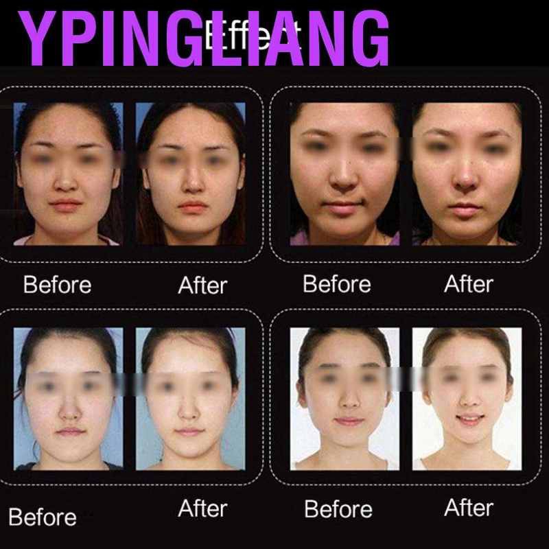 Ypingliang 10 Pcs Face Slim Masks  V Shaped Faces Moisturizing Skin Mask Tightening Lifting Patch