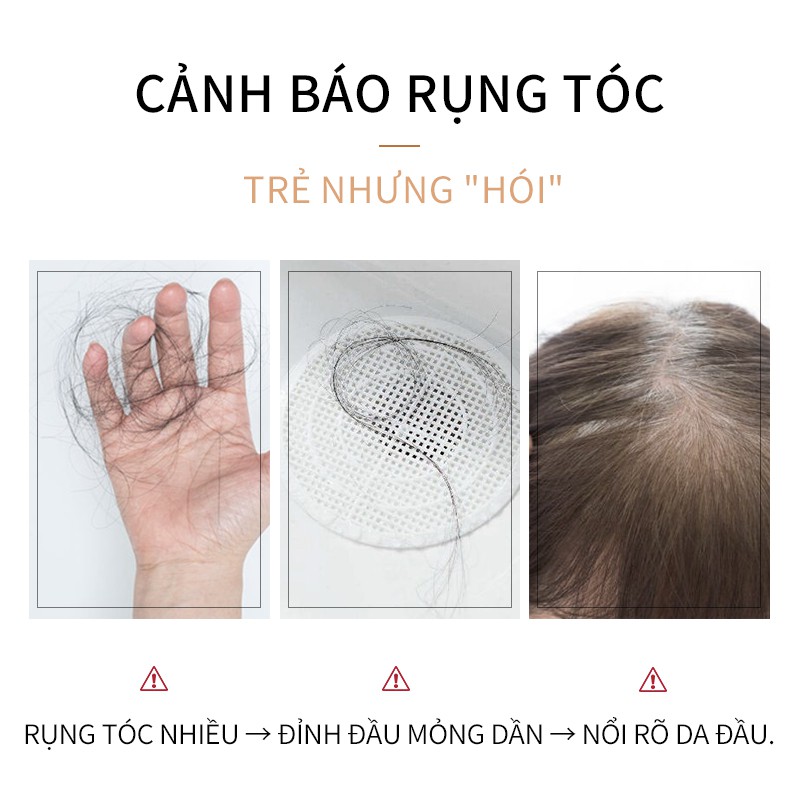 KOPYRROL Nhanh KíCh ThíCh MọC TóC Serum 60g
