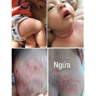 kem mul rose mới nhất