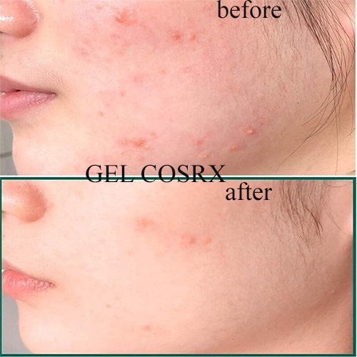 Gel Rửa Mặt Tràm Trà COSRX Low pH Good Morning Gel Cleanser 150ml [Belux] | BigBuy360 - bigbuy360.vn