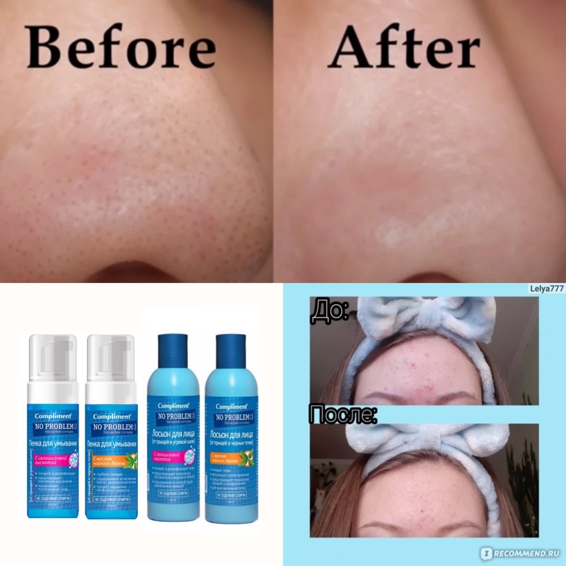 FOAM rửa mặt cho da mụn và nhạy cảm COMPLIMENT NO PROBLEM với acid salicylic và chiết xuất tràm trà