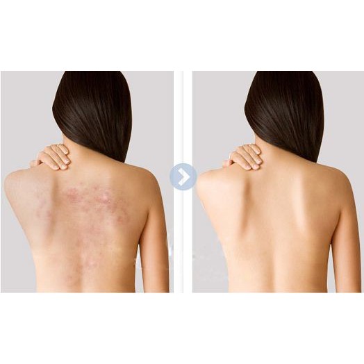 Xà phòng Giảm mụn lưng For Back Nhật