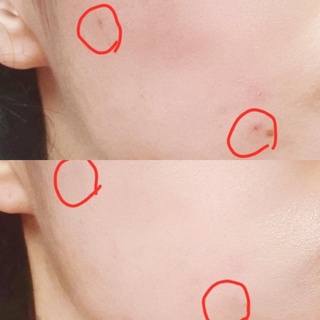 Tinh Chất Cấp Nước Smas HA Plus Serum 100ml