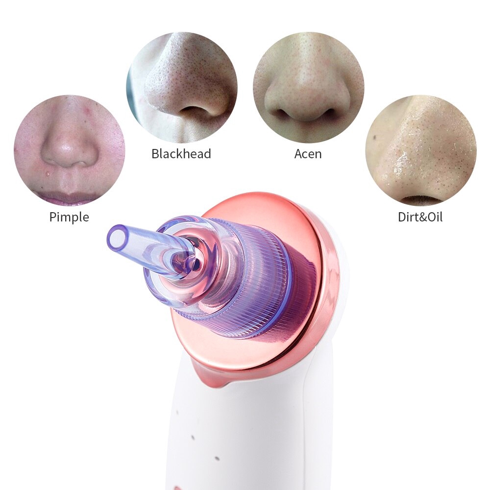 Máy hút mụn đầu đen/mụn trứng cá FOREVERLILY làm sạch da mặt chăm sóc hiệu quả