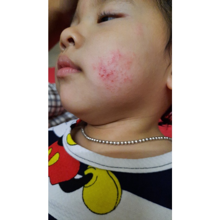 Kem đu đủ đa năng Lucas’ Papaw Ointment 25gr